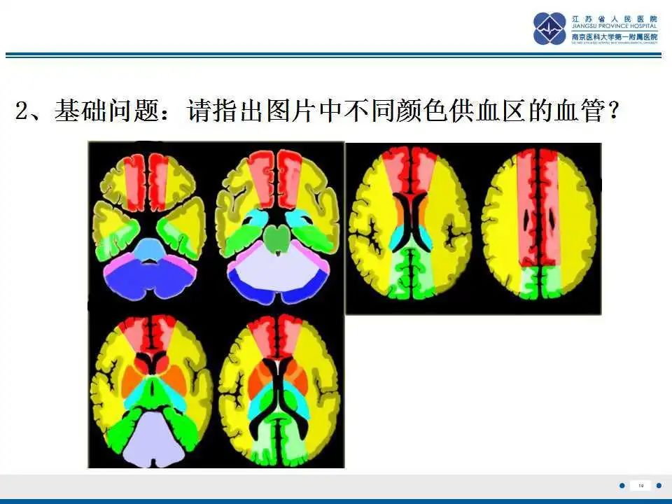 影像PPT - 【PPT】特鲁索综合征 Trousseau snydrome-11