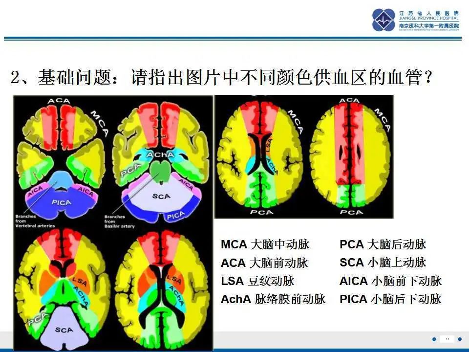 影像PPT - 【PPT】特鲁索综合征 Trousseau snydrome-12