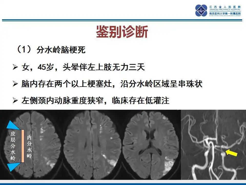 影像PPT - 【PPT】特鲁索综合征 Trousseau snydrome-27