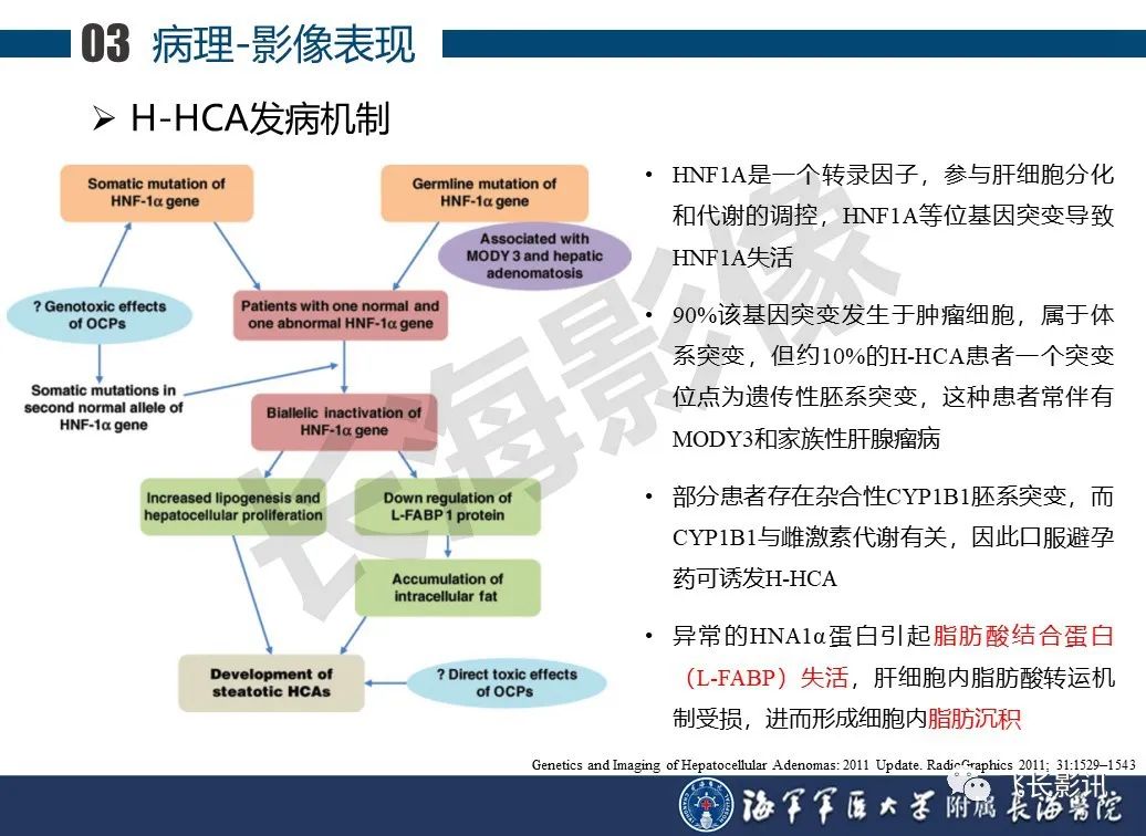 影像PPT - 【PPT】肝细胞腺瘤的影像学诊断-20
