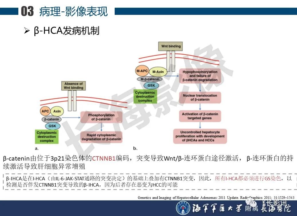 影像PPT - 【PPT】肝细胞腺瘤的影像学诊断-29