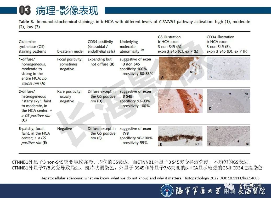 影像PPT - 【PPT】肝细胞腺瘤的影像学诊断-31