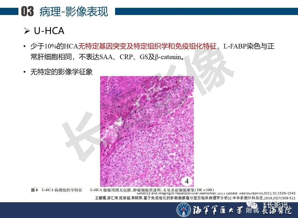 影像PPT - 【PPT】肝细胞腺瘤的影像学诊断-36