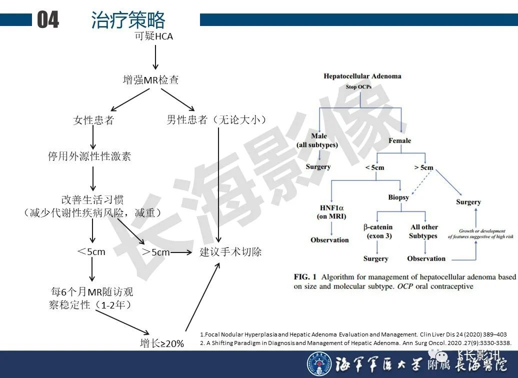 影像PPT - 【PPT】肝细胞腺瘤的影像学诊断-47