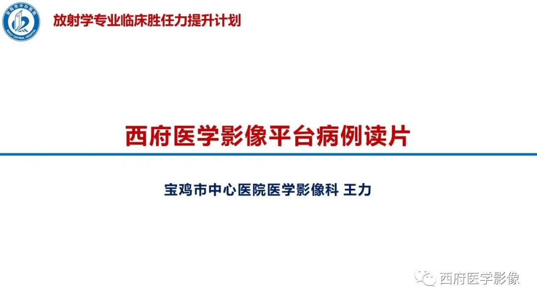影像PPT - 【PPT】特鲁索综合征影像诊断与鉴别-1