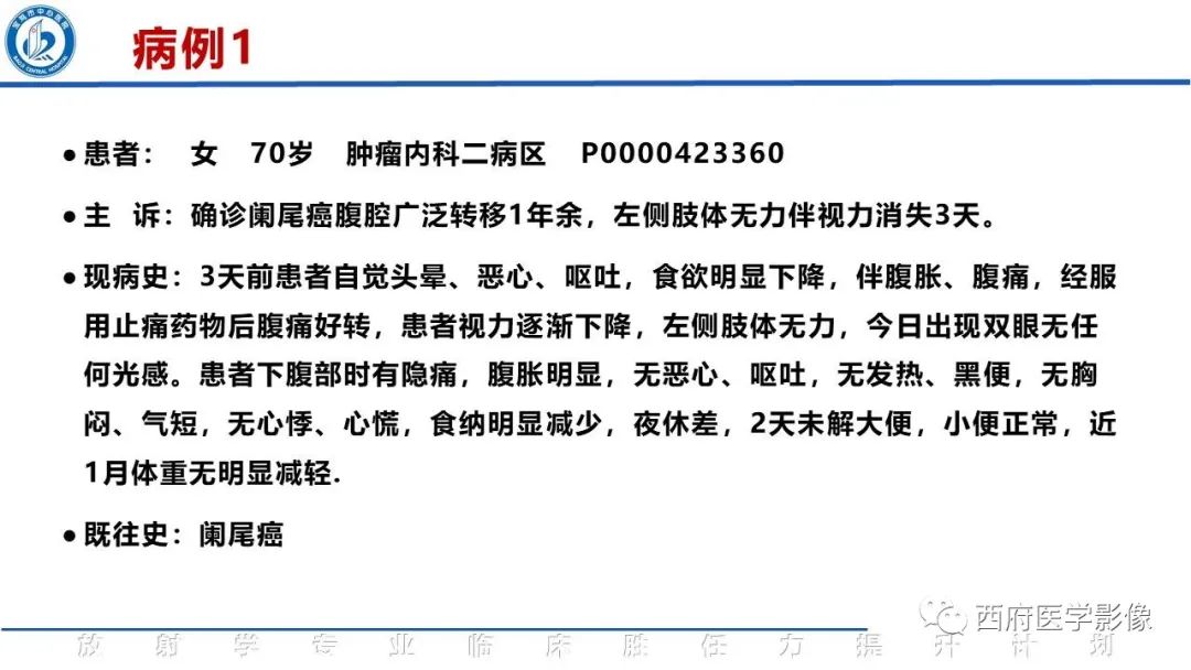 影像PPT - 【PPT】特鲁索综合征影像诊断与鉴别-2