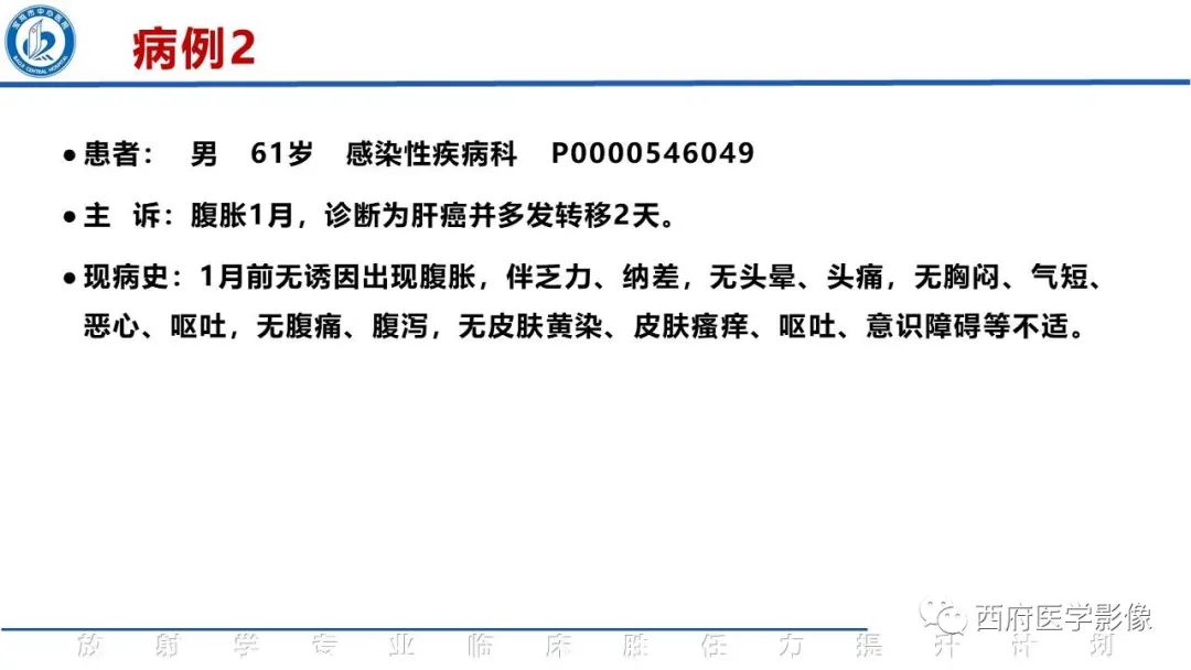 影像PPT - 【PPT】特鲁索综合征影像诊断与鉴别-6