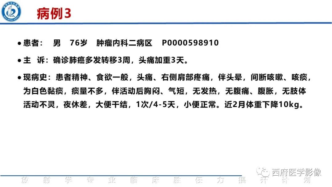 影像PPT - 【PPT】特鲁索综合征影像诊断与鉴别-10
