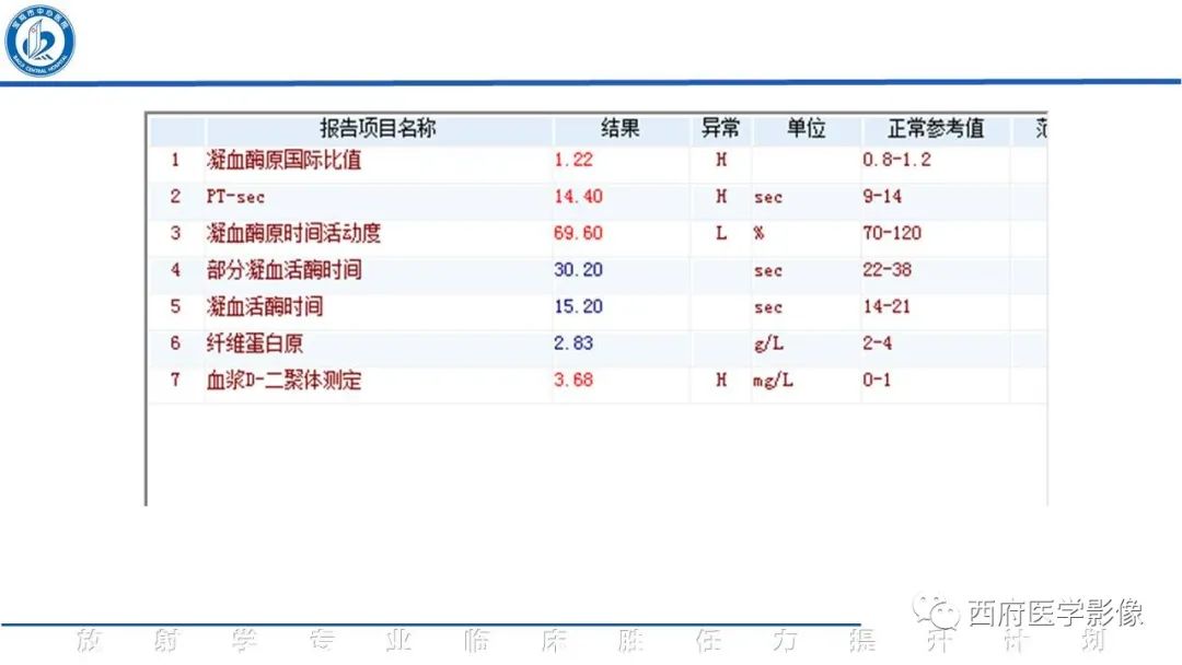 影像PPT - 【PPT】特鲁索综合征影像诊断与鉴别-11