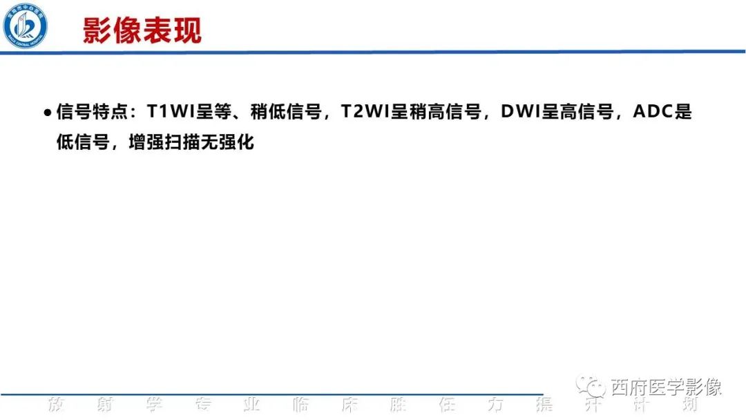 影像PPT - 【PPT】特鲁索综合征影像诊断与鉴别-20