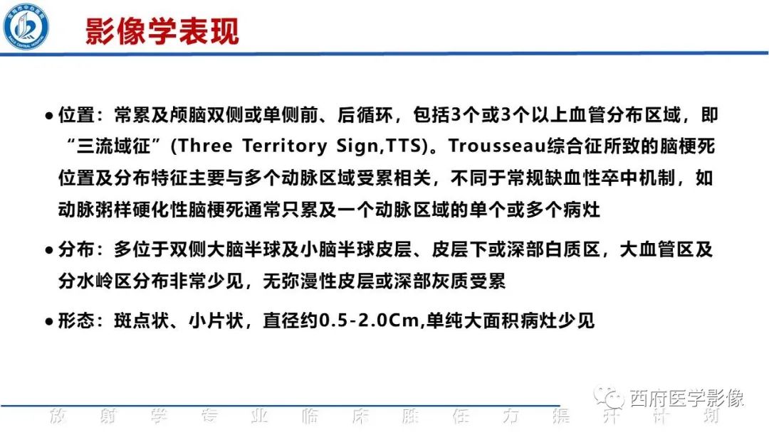 影像PPT - 【PPT】特鲁索综合征影像诊断与鉴别-19