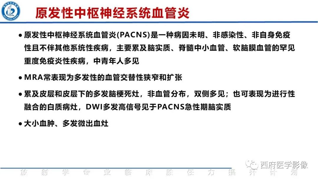 影像PPT - 【PPT】特鲁索综合征影像诊断与鉴别-27