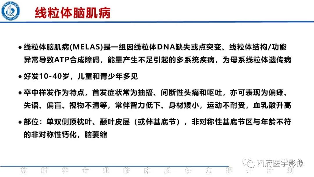 影像PPT - 【PPT】特鲁索综合征影像诊断与鉴别-30