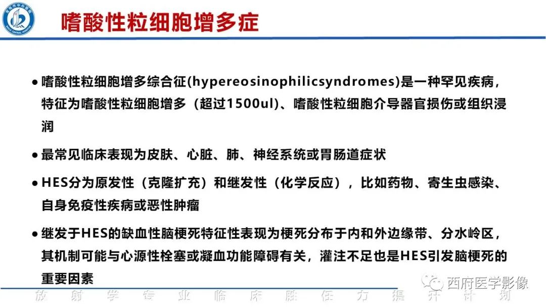 影像PPT - 【PPT】特鲁索综合征影像诊断与鉴别-3