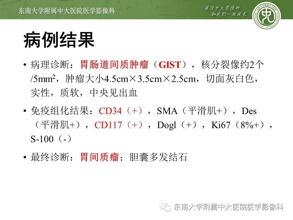 影像PPT - 【PPT】胃肠道间质瘤GIST-3