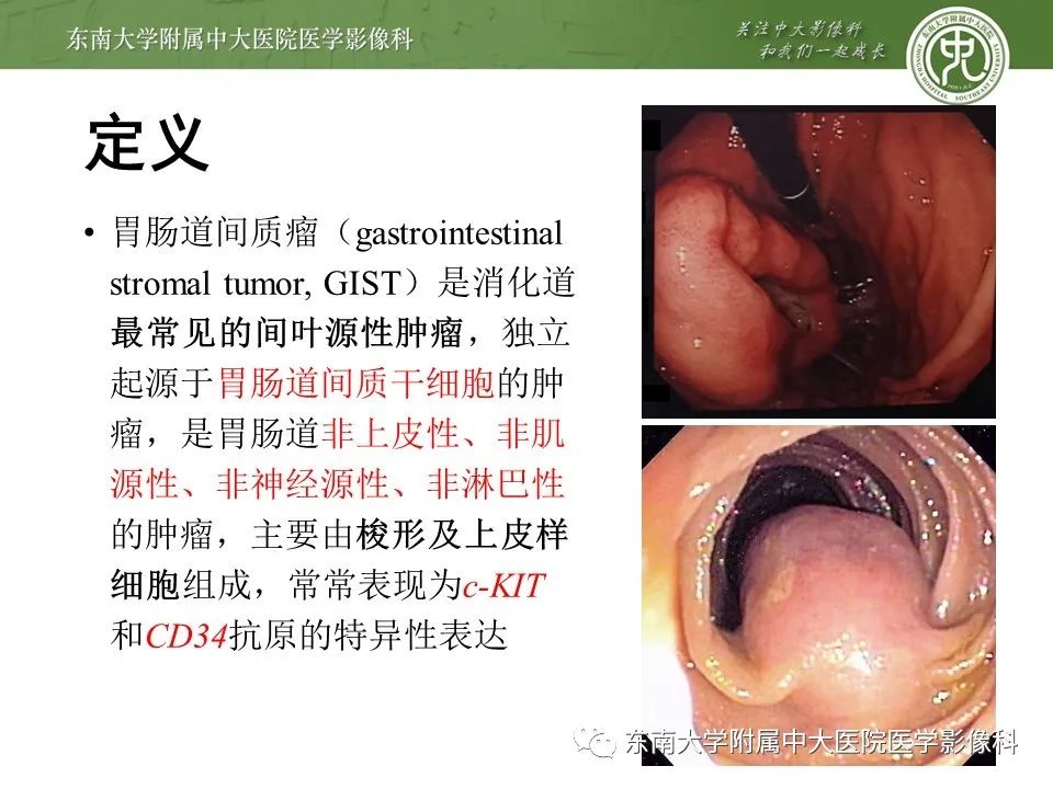 影像PPT - 【PPT】胃肠道间质瘤GIST-5