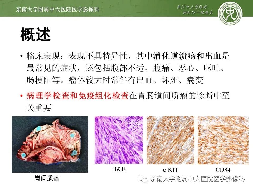 影像PPT - 【PPT】胃肠道间质瘤GIST-6