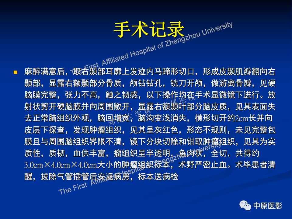 影像PPT - 【病例】脱髓鞘假瘤1例MR影像-13