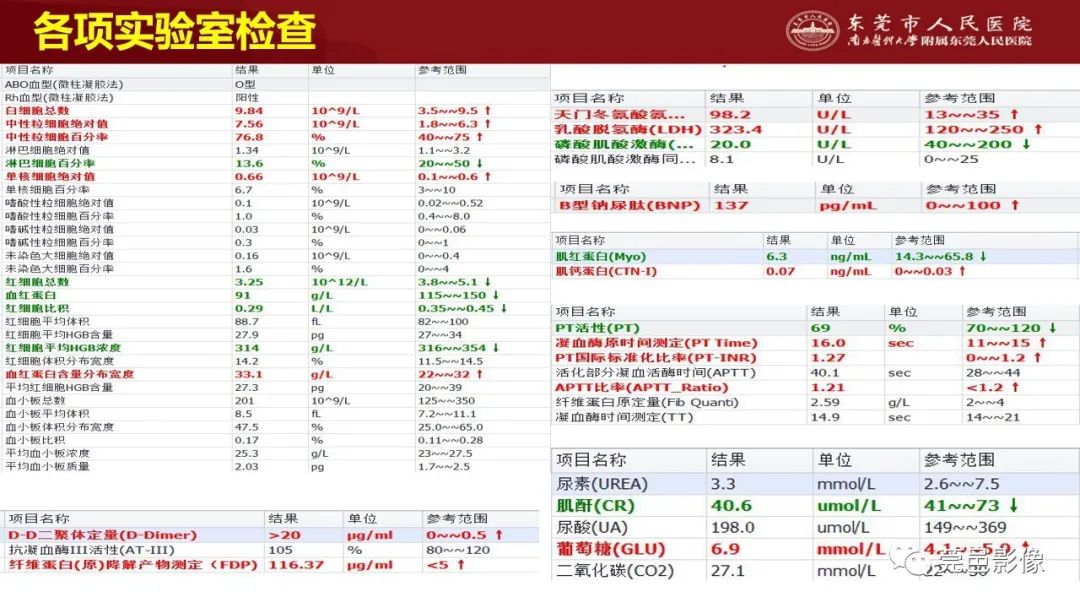 影像PPT - 【PPT】特鲁索综合征影像诊断-3
