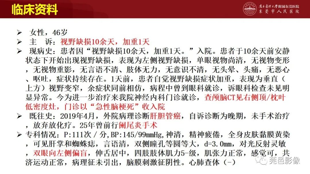 影像PPT - 【PPT】特鲁索综合征影像诊断-2