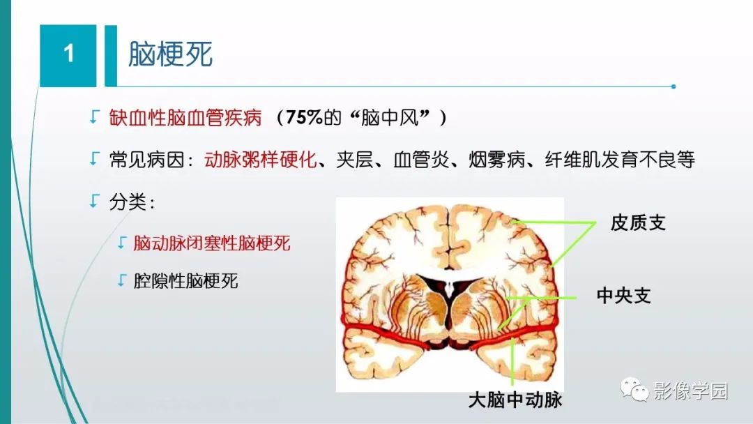影像PPT - 【PPT】脑血管疾病的影像学诊断-4