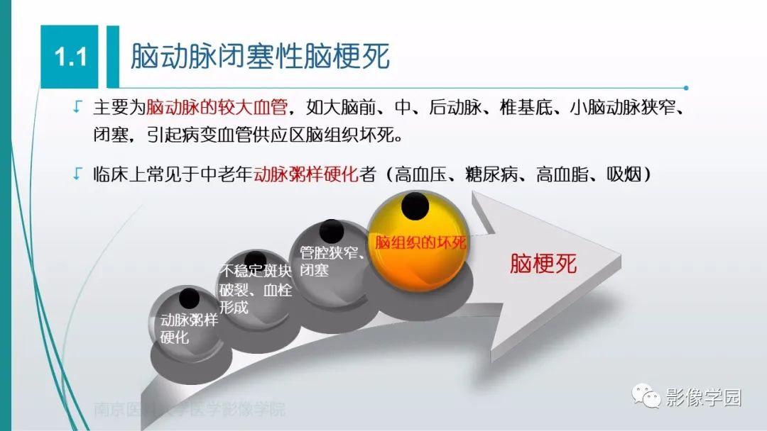 影像PPT - 【PPT】脑血管疾病的影像学诊断-5