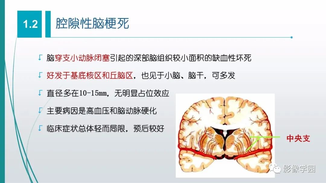 影像PPT - 【PPT】脑血管疾病的影像学诊断-22