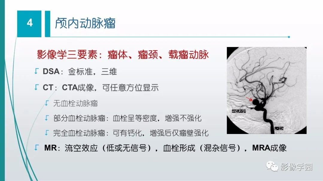 影像PPT - 【PPT】脑血管疾病的影像学诊断-43
