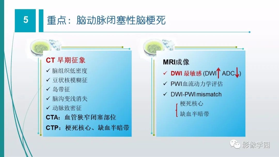 影像PPT - 【PPT】脑血管疾病的影像学诊断-47