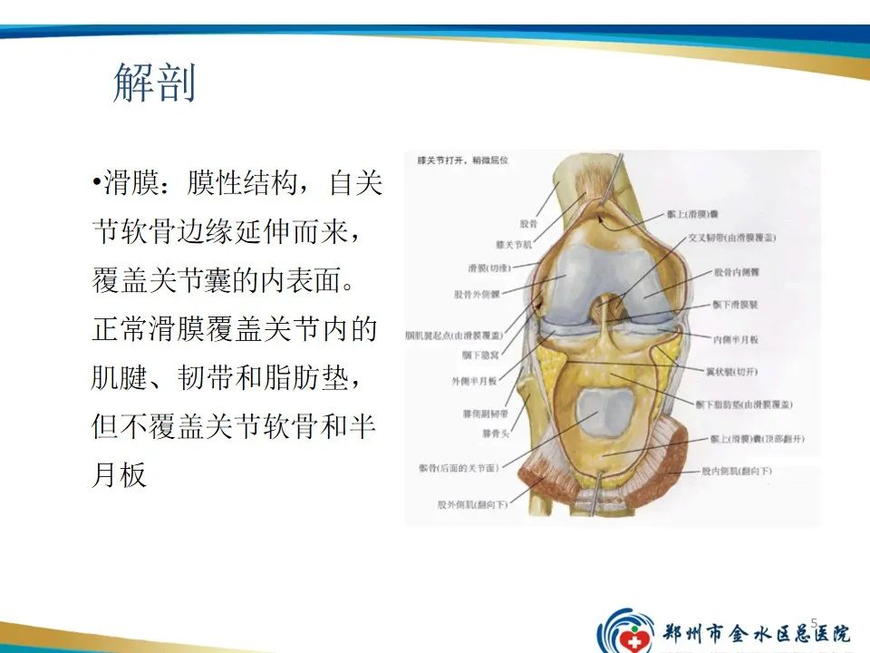 影像PPT - 【PPT】色素沉着绒毛结节性滑膜炎-5