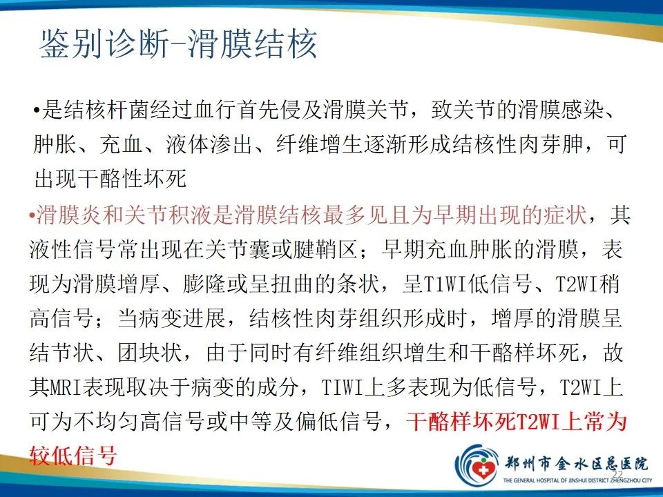 影像PPT - 【PPT】色素沉着绒毛结节性滑膜炎-22