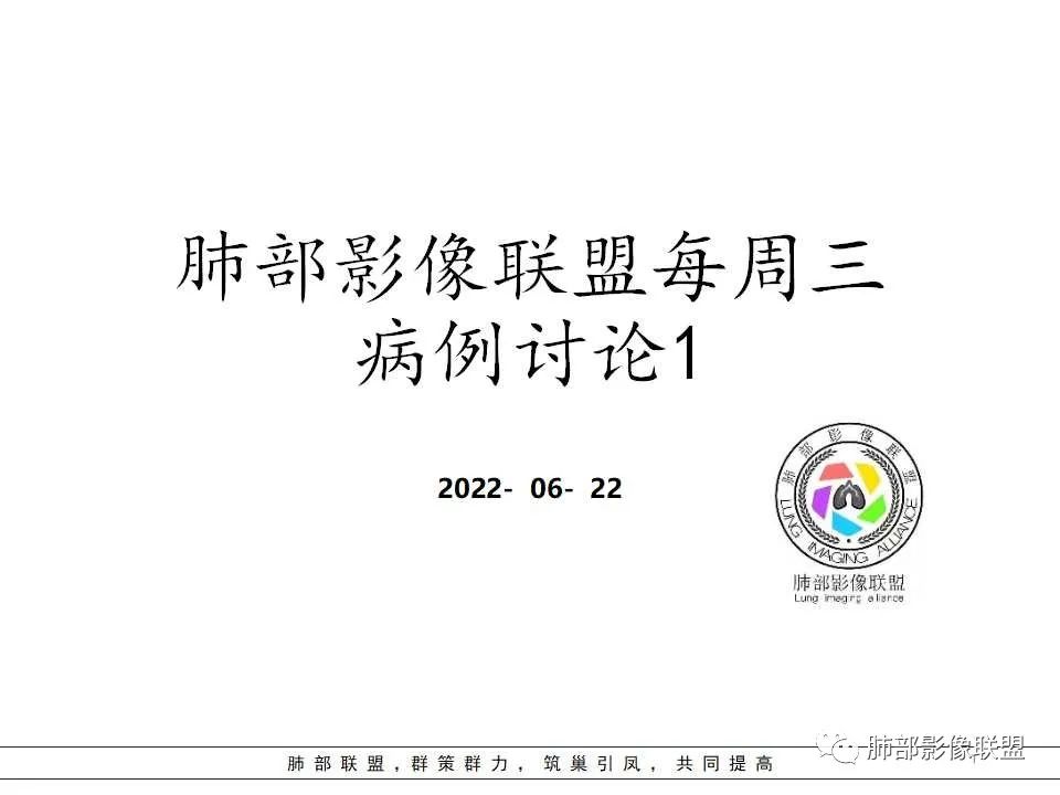 影像PPT - 【病例】慢性嗜酸性粒细胞肺炎影像分析-1 影像PPT - 【病例】慢性嗜酸性粒细胞肺炎影像分析-1