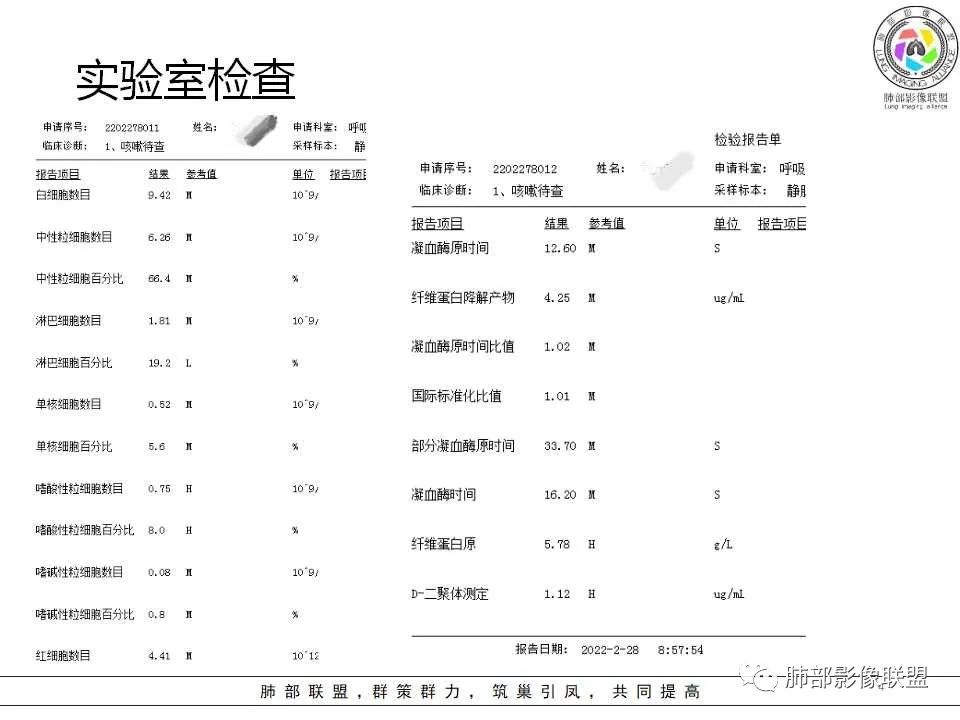 影像PPT - 【病例】慢性嗜酸性粒细胞肺炎影像分析-4 影像PPT - 【病例】慢性嗜酸性粒细胞肺炎影像分析-4
