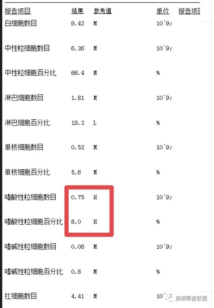 影像PPT - 【病例】慢性嗜酸性粒细胞肺炎影像分析-24 影像PPT - 【病例】慢性嗜酸性粒细胞肺炎影像分析-24