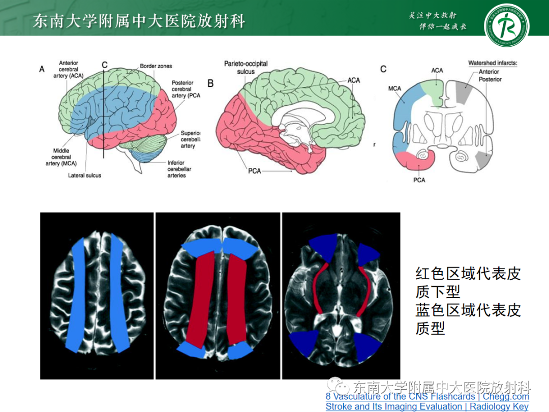 影像PPT - 【PPT】特鲁索综合征-13 影像PPT - 【PPT】特鲁索综合征-13