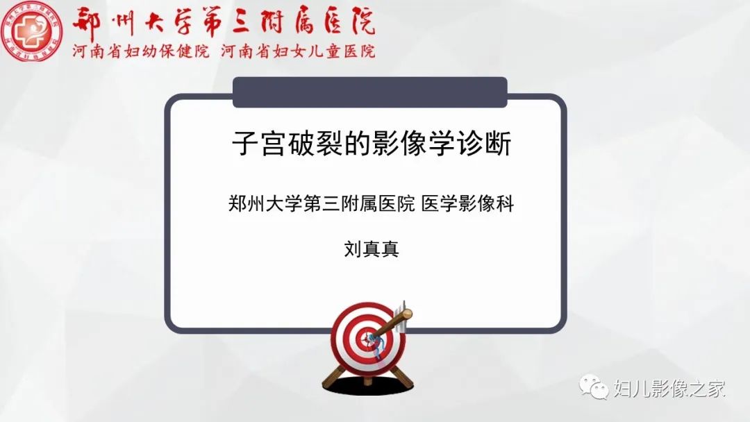 影像PPT - 【PPT】子宫破裂的影像诊断-1