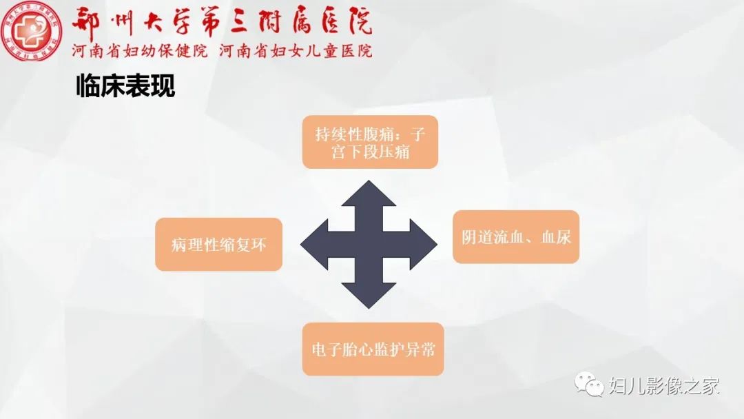 影像PPT - 【PPT】子宫破裂的影像诊断-4