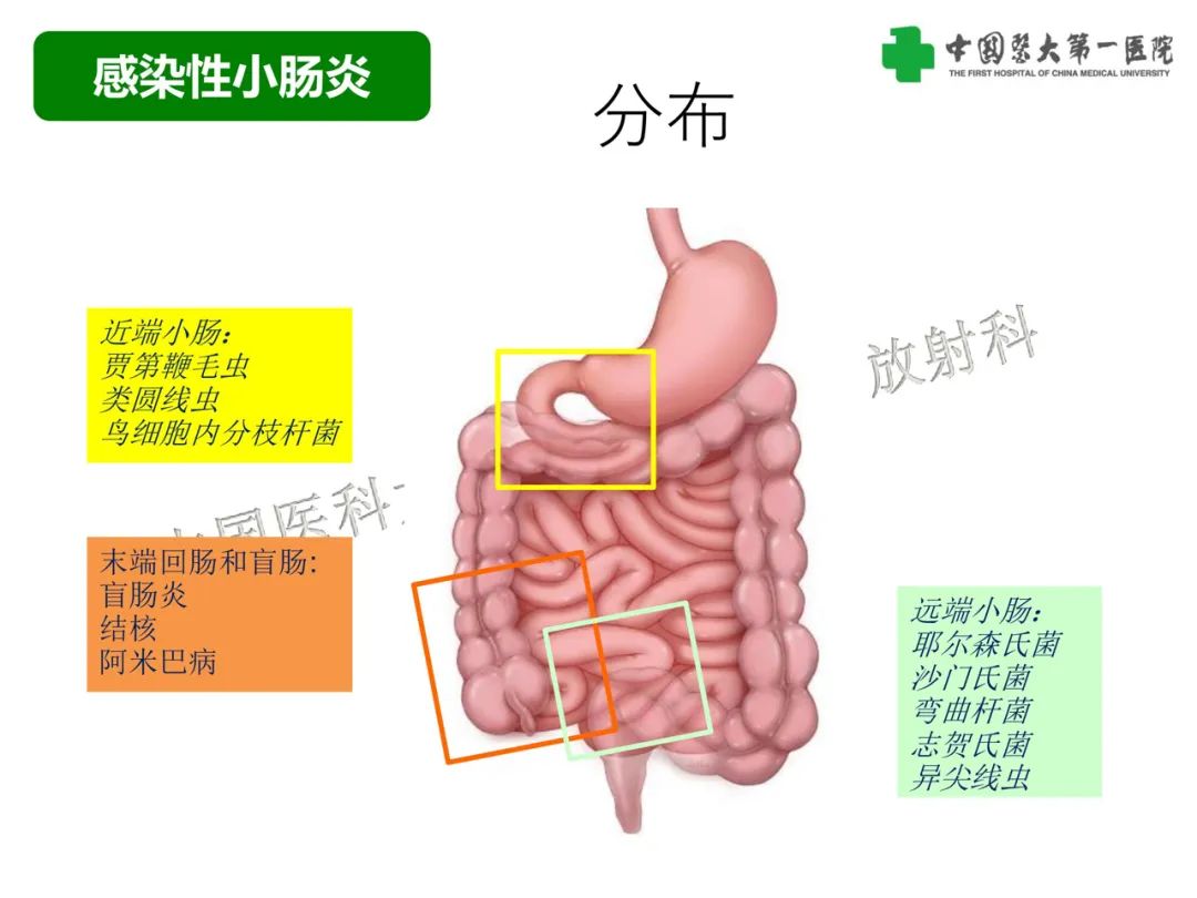 影像PPT - 【PPT】急性感染性 炎症性及缺血性肠炎的鉴别-9