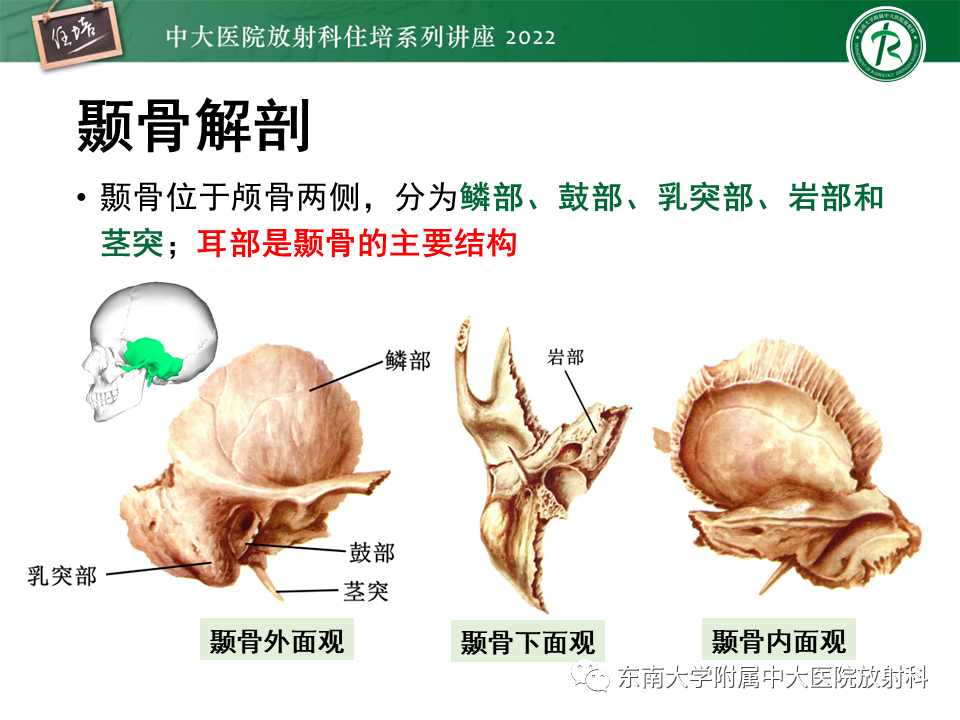 影像PPT - 【PPT】耳颞部发育异常影像评估-3