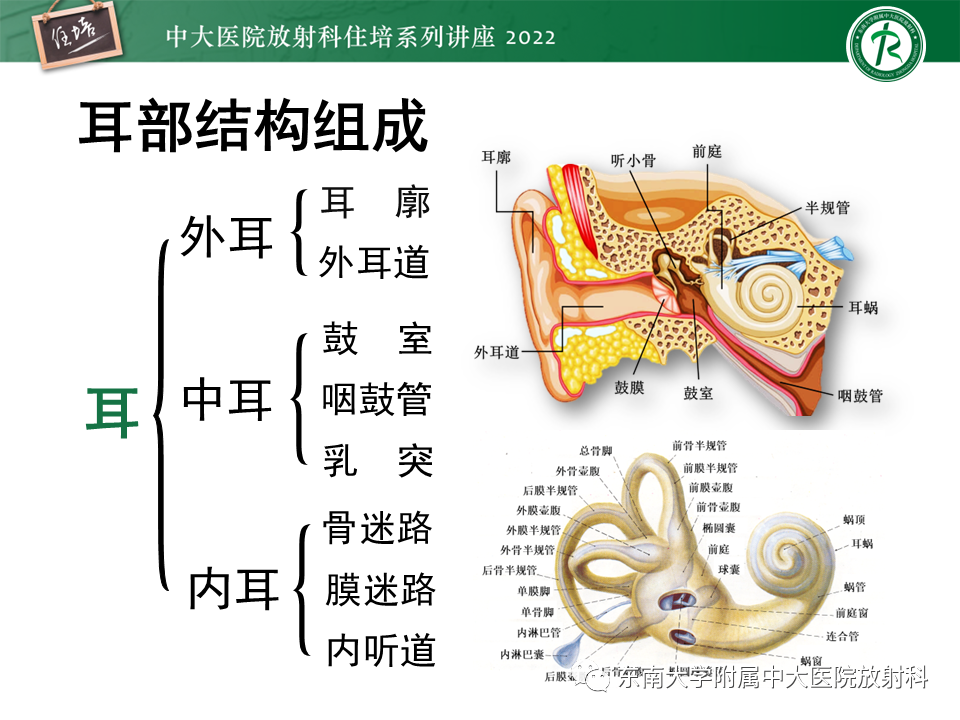 影像PPT - 【PPT】耳颞部发育异常影像评估-4