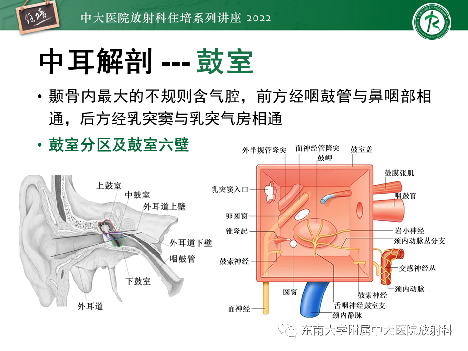 影像PPT - 【PPT】耳颞部发育异常影像评估-6