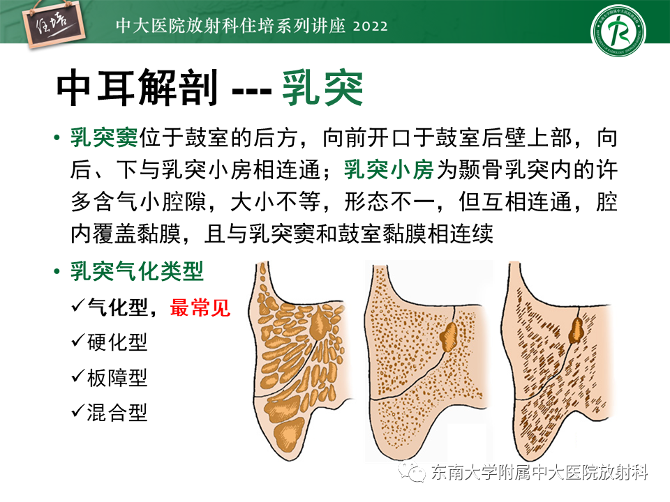 影像PPT - 【PPT】耳颞部发育异常影像评估-8