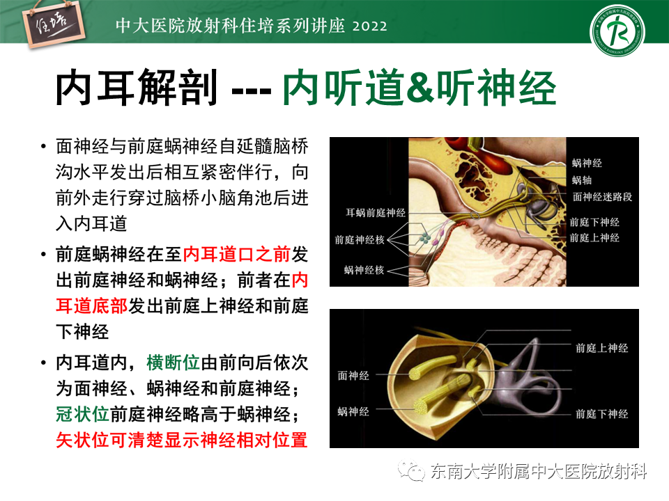 影像PPT - 【PPT】耳颞部发育异常影像评估-10