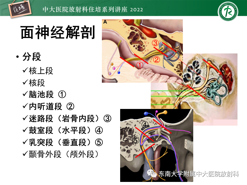 影像PPT - 【PPT】耳颞部发育异常影像评估-11