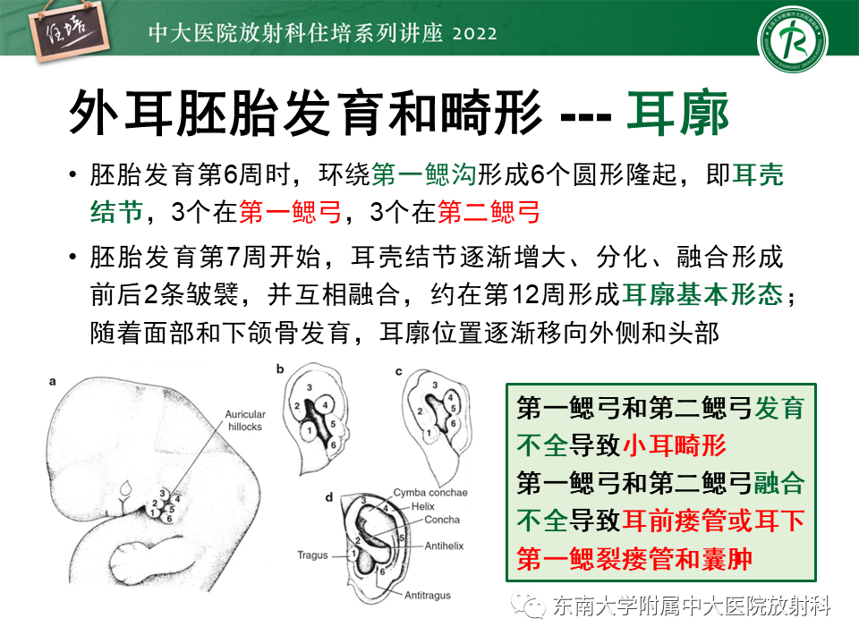 影像PPT - 【PPT】耳颞部发育异常影像评估-13