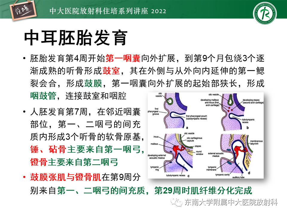 影像PPT - 【PPT】耳颞部发育异常影像评估-15