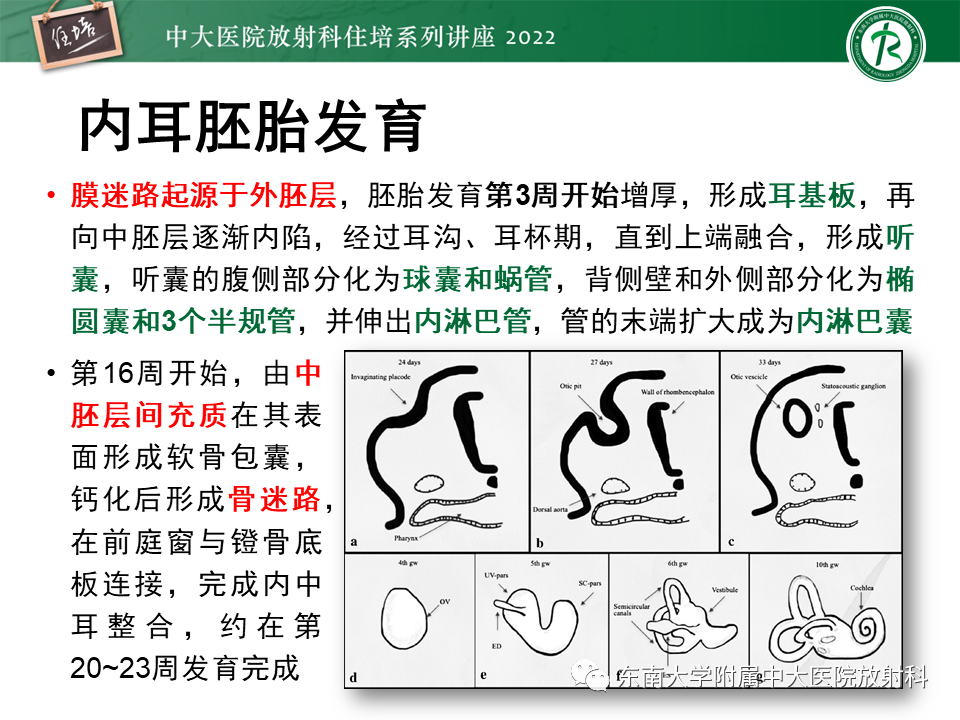 影像PPT - 【PPT】耳颞部发育异常影像评估-17