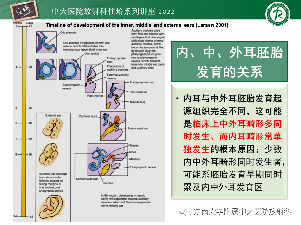 影像PPT - 【PPT】耳颞部发育异常影像评估-19
