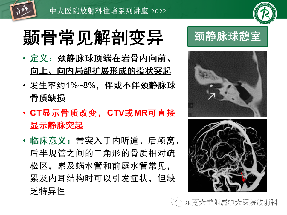 影像PPT - 【PPT】耳颞部发育异常影像评估-37