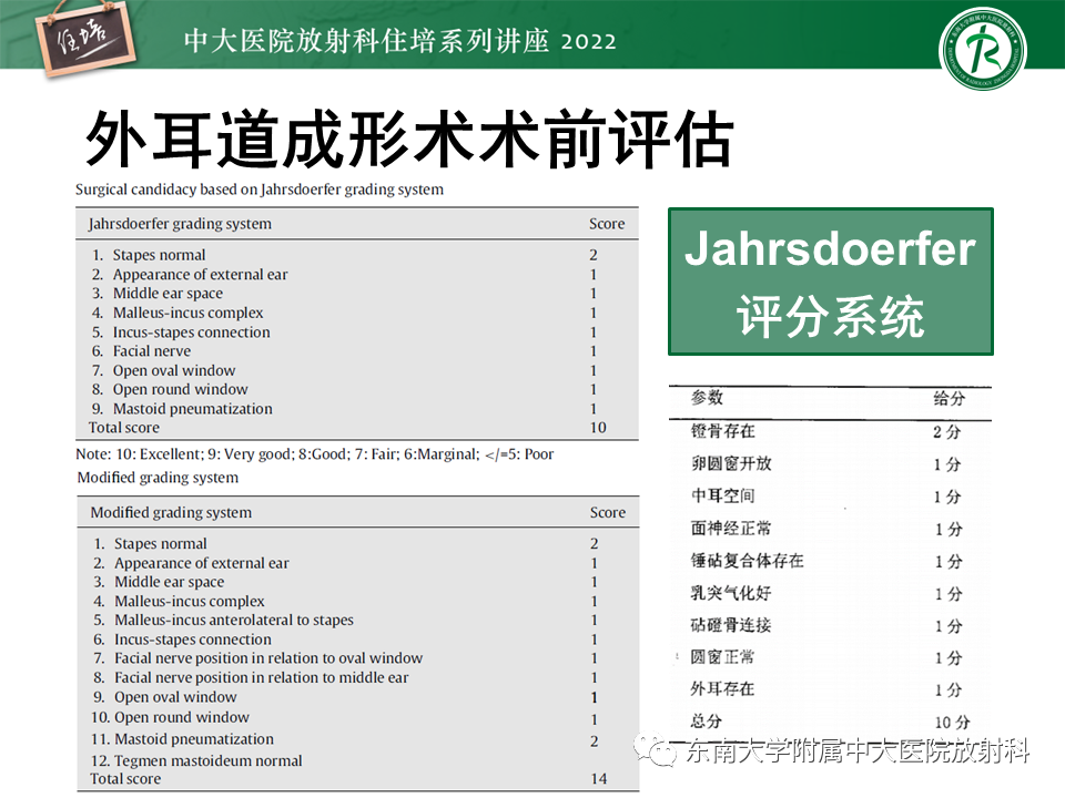 影像PPT - 【PPT】耳颞部发育异常影像评估-43